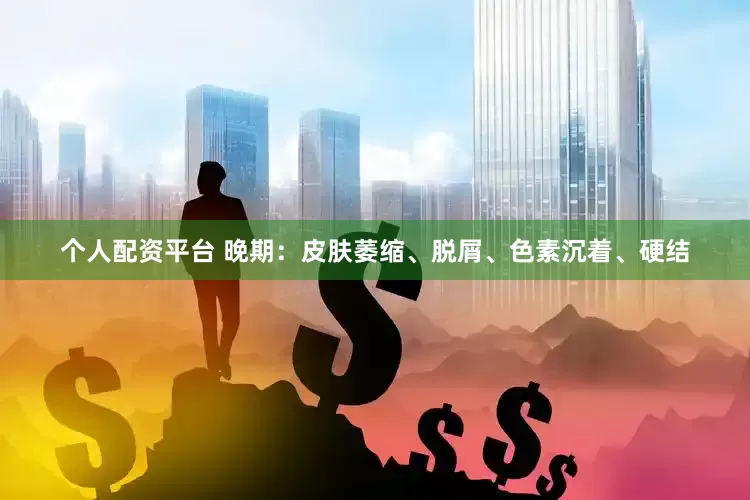 个人配资平台 晚期：皮肤萎缩、脱屑、色素沉着、硬结